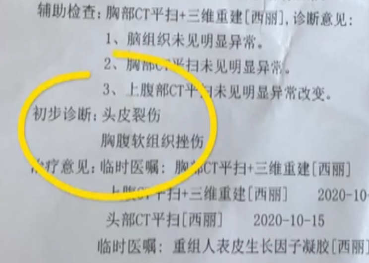 高管降薪降职，企业变革中的双刃剑效应