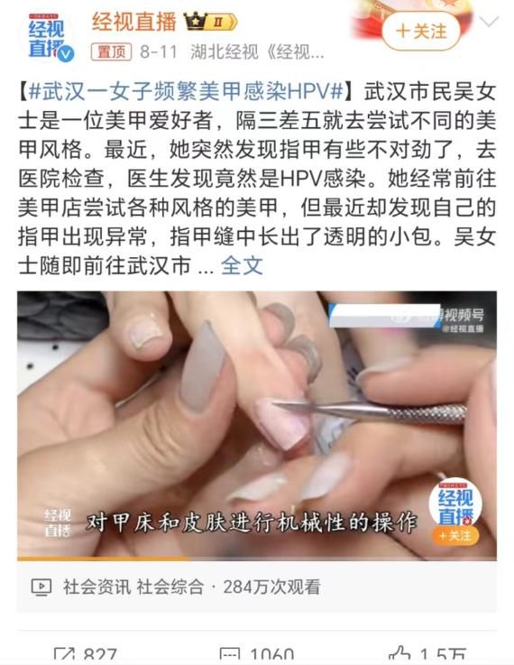 女子美甲后感染HPV病毒长出菜花，该如何应对？